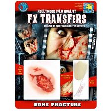 tinsley-3d-transfer-bone-fracture